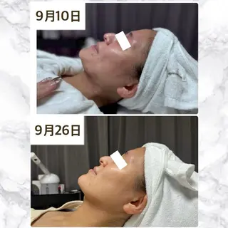 ROR Akariのエステ・リラクイメージ