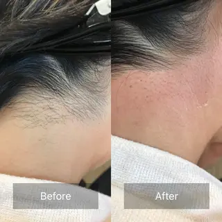 nouvelle  plume所属・ヌーベル プリュムのエステ・リラクイメージ