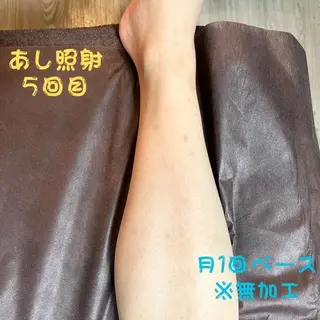 メンズ キッズ メンズ脱毛　FELISSE【フェリッセ】所属・メンズ脱毛フェリッセ /男女🆗キッズ🆗のエステ・リラクイメージ