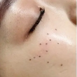 シミケア/ハーブピーリング/脱毛/小顔フェイシャル/ハーブ温浴　LAULEA所属・素肌をキレイに ラウレア🌼Hayaのエステ・リラクイメージ