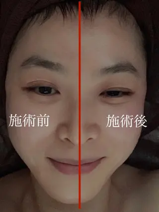 東洋エステToyou-beauty所属・東洋エステサロン 姫路のエステ・リラクイメージ