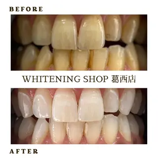 メンズ ホワイトニング ショップ葛西店のその他イメージ