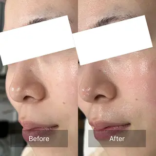 De'Im福井店所属・【福井シェアサロン】 青木優奈のエステ・リラクイメージ