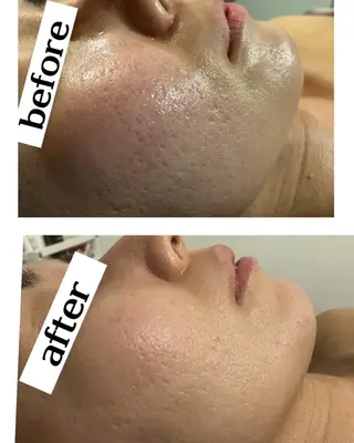 Dione湘南藤沢店 ×LUANA　齋藤のエステ・リラクイメージ