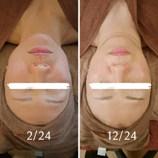 鍼灸サロンmiyabi所属・美容鍼×エステ 鍼灸 サロンmiyabiのエステ・リラクイメージ