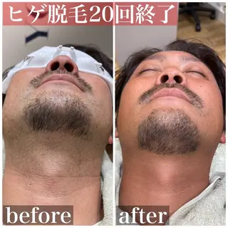 HAIRS YOSHIOKA所属・ヘアーズヨシオカ MENSヒゲ脱毛のエステ・リラクイメージ