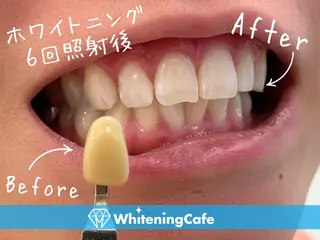 ホワイトニングカフェ徳島沖浜店所属・ホワイトニングカフェ 徳島沖浜店のエステ・リラクイメージ