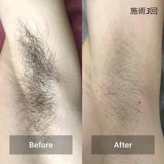 メンズ アルカンジュ~archange~所属・痩身/毛穴洗浄/脱毛 アルカンジュのエステ・リラクイメージ