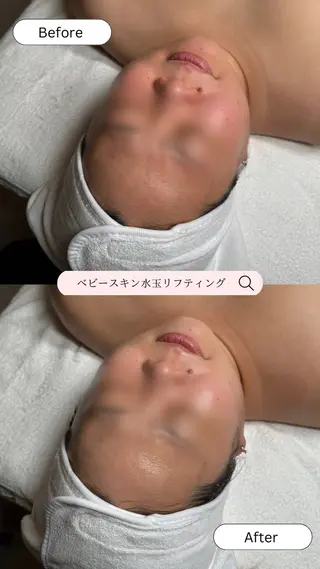 韓国肌管理🫧LDM 🫧Junnaのエステ・リラクイメージ