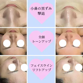 🎀美肌サロン レイビス川崎店🎀のエステ・リラクイメージ