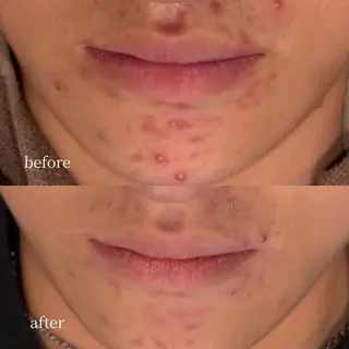 韓国肌管理・肌質改善 EARNEST心斎橋のエステ・リラクイメージ