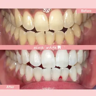 セルフホワイトニング エクシア札幌琴似店のその他イメージ