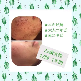 ミディアム カラー パーマ ヘアアレンジ メンズ キッズ ネイル マツエク・マツパ ニキビ・肌質改善専門 ♡人生が変わるサロンのエステ・リラクイメージ