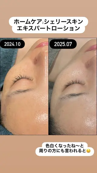 LiZA エステティックサロンのエステ・リラクイメージ