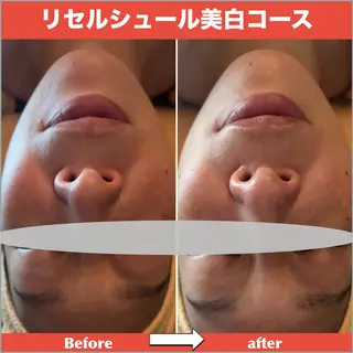 女性専用エステルーム Rerelaリレラのエステ・リラクイメージ