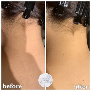 メンズ ビューティーサロン リノア心斎橋店のエステ・リラクイメージ