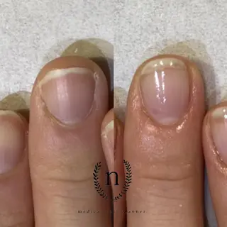 ネイル Rio 𓍼のネイルデザイン