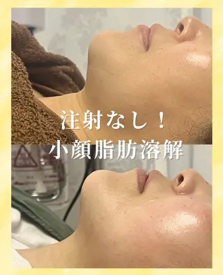 看護師が施術する ナスサロ/Emi🪽のエステ・リラクイメージ