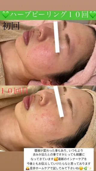 メンズ Salon de Lino 御器所のエステ・リラクイメージ