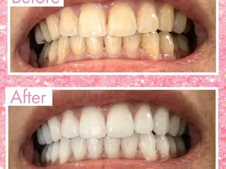 エクシア町田店所属・miku .のエステ・リラクイメージ