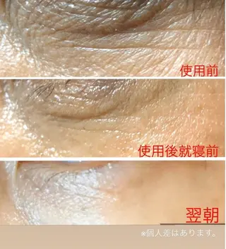 evergreen /眉毛•耳つぼのエステ・リラクイメージ