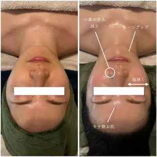 ヒラキ ハルナのエステ・リラクイメージ