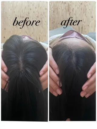 ate'所属・個室ドライヘッドスパ 🍃moriのエステ・リラクイメージ