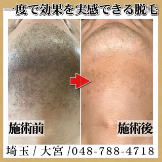 脱毛＆フェイシャル TOWA大宮のエステ・リラクイメージ