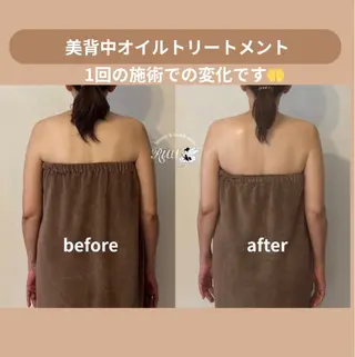 【頭痛、睡眠改善】 salon RUUのエステ・リラクイメージ