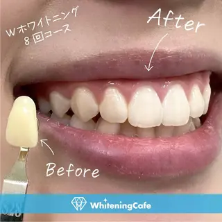 ホワイトニングカフェ神戸元町店所属・ホワイトニングカフェ 神戸元町店のエステ・リラクイメージ