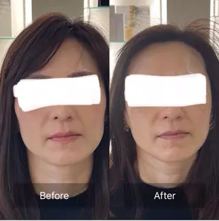 beauty salon y3所属・南野 琉夏のエステ・リラクイメージ