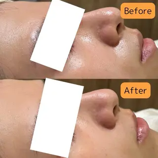 肌質改善美容サロン ému 用賀のエステ・リラクイメージ