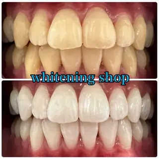 ホワイトニング ショップ吉祥寺店のエステ・リラクイメージ