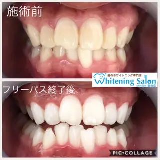 歯科レベルの白さ💎 ✨ホワイトニング豊田のエステ・リラクイメージ