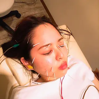 むくみたるみ専門☆ 美容鍼・小顔矯正のエステ・リラクイメージ