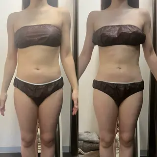 ハイパーナイフ専門店 Salon de COCO所属・Salon de COCOのエステ・リラクイメージ