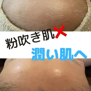 肌荒れに悩む方のため オイルフリーサロンのマツエク・マツパデザイン