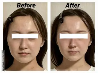 小顔矯正Sho  FaceDesignのエステ・リラクイメージ