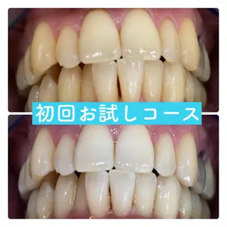 PLATINUM Beauty 横浜店所属・ホワイトニングルーム 横浜店のその他イメージ