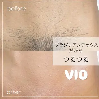 ワックス脱毛🌈 ESPOIRnocoのエステ・リラクイメージ