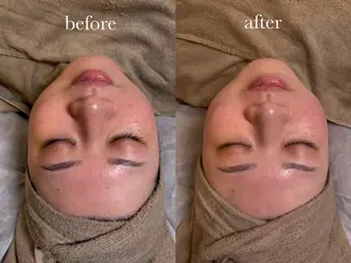 ENNE Lash&Blow by&ERA所属・ENNE🦩小顔整体 師🌿 HINAKOのエステ・リラクイメージ