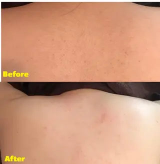 代表 MOMOのエステ・リラクイメージ