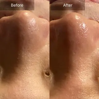 Mandarin Orange所属・毛穴から始める肌メン テマンダリンオレンジのエステ・リラクイメージ