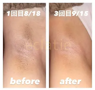 eclatie（エクラティエ）所属・横井 愛奈のエステ・リラクイメージ