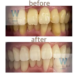 ホワイトニング ショップ船橋2号店のエステ・リラクイメージ