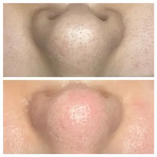 crescent 福寿のマツエク・マツパデザイン