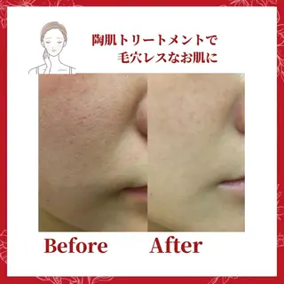 ミディアム カラー パーマ ヘアアレンジ メンズ キッズ ネイル マツエク・マツパ Amaryllis 🌹のエステ・リラクイメージ