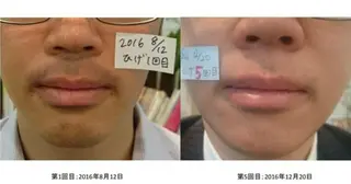 Salon pupa 店長のエステ・リラクイメージ