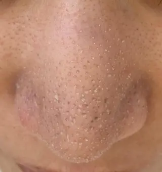 Ummi所属・肌管理／眉毛．まつ毛 陽子の眉毛・アイブロウイメージ