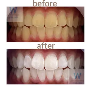 ホワイトニング ショップ本八幡店のエステ・リラクイメージ